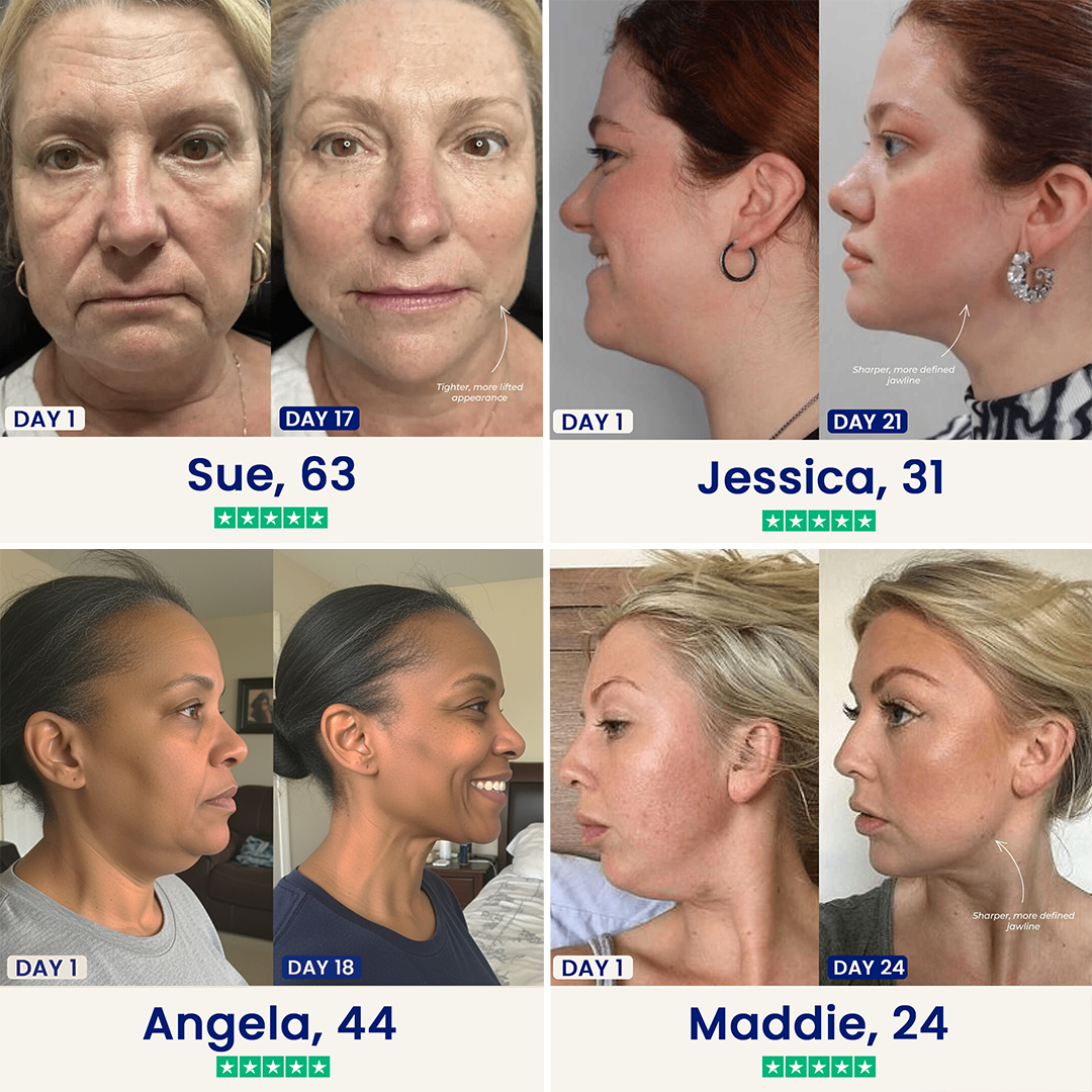 Balabu™ Double Chin Lifting Mask