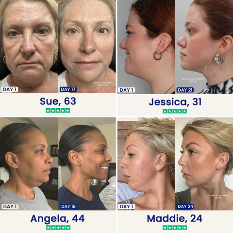 Balabu™ Double Chin Lifting Mask