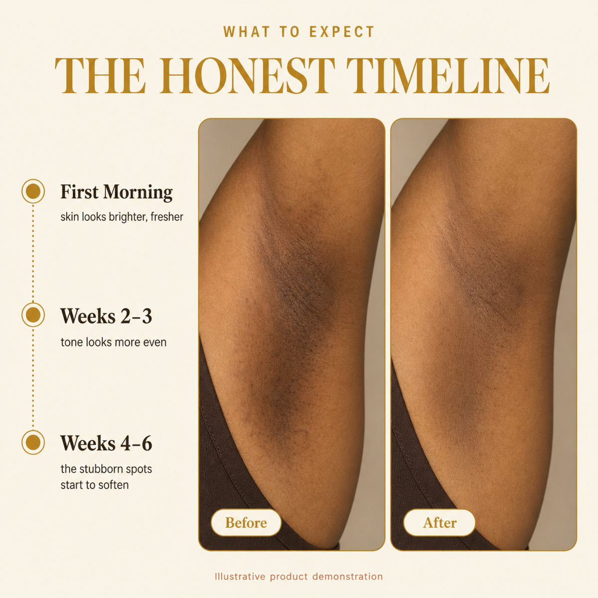 Balabu Turmeric & Kojic Bar — Two-Front Starter Ritual