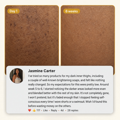 Balabu Turmeric & Kojic Bar — Two-Front Starter Ritual
